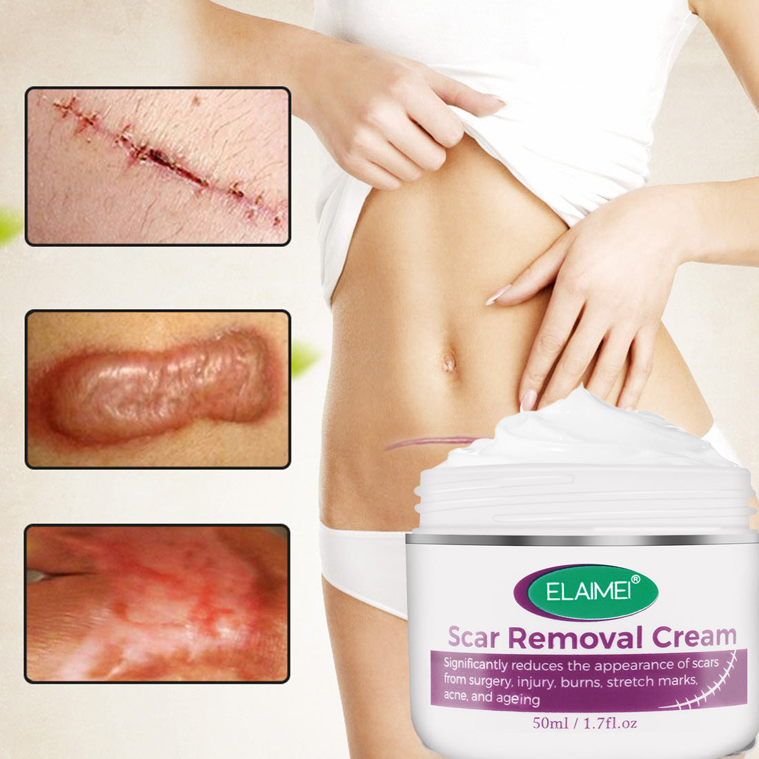Crème Réparatrice Peau & Vergetures – Effet Anti-Cicatrices, Anti-Imperfections